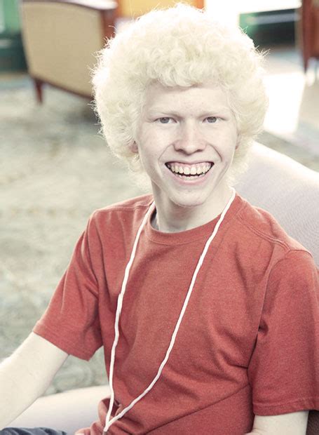 albino feio|About albinism. Beyond Race, Ethnicity and Gender